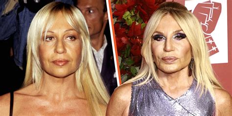 donatella versace plastic surgery before|Donatella Versace facelift.